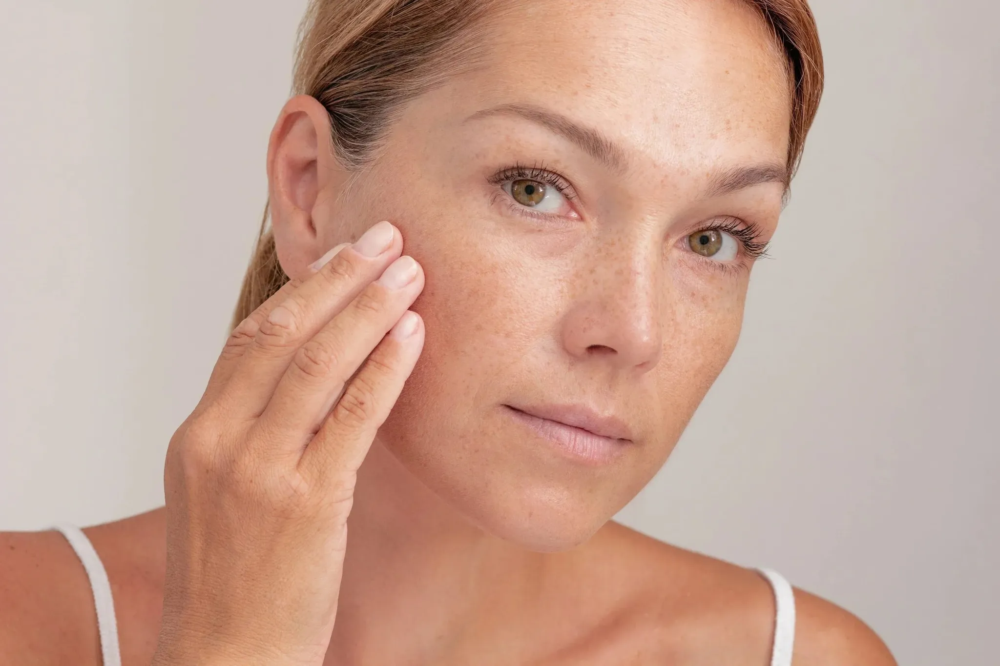 What Are Sunspots — and How Can You Fade Them? - The Purest Solutions | Skincare that actually works