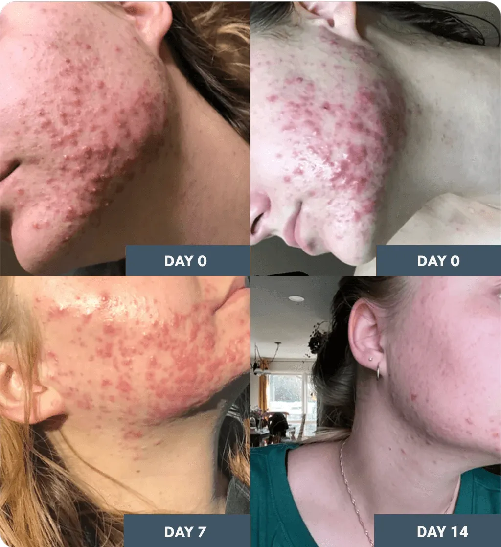 Before and after results