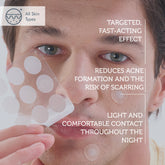 Microneedle Technology Acne Patches