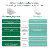 Microneedle Technology Acne Patches